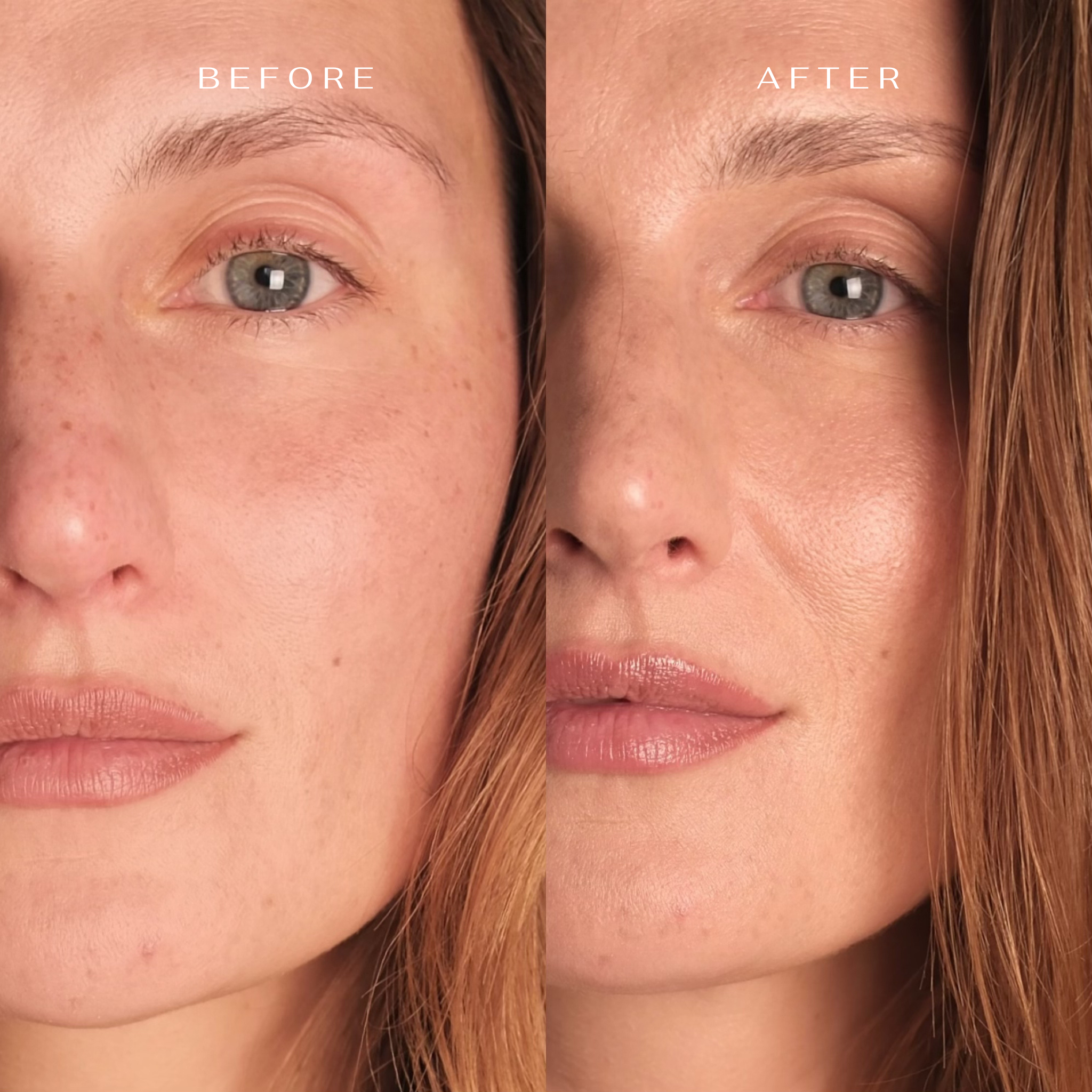 Švelniai valantis ir intensyviai drėkinantis rinkinys veidui ir kaklui