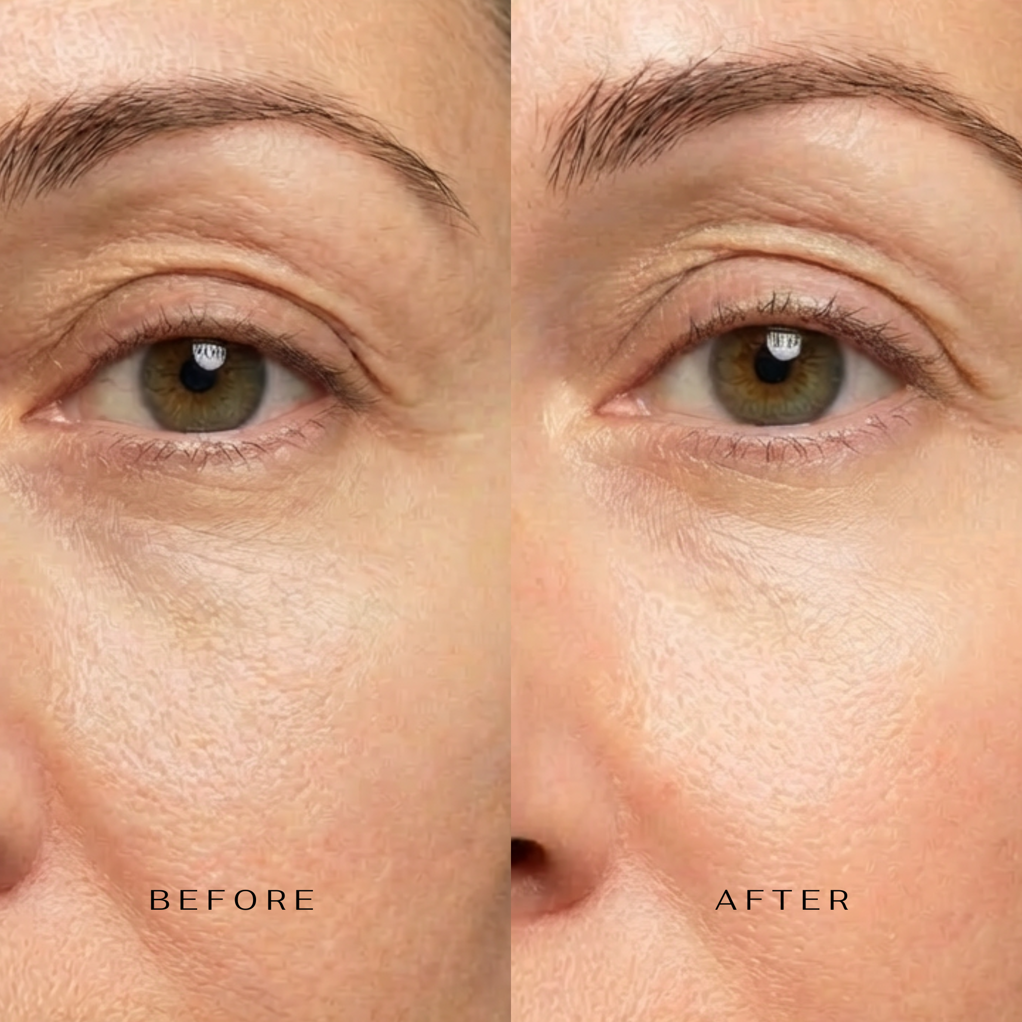 5 Minute Revolution Under-Eye Patches