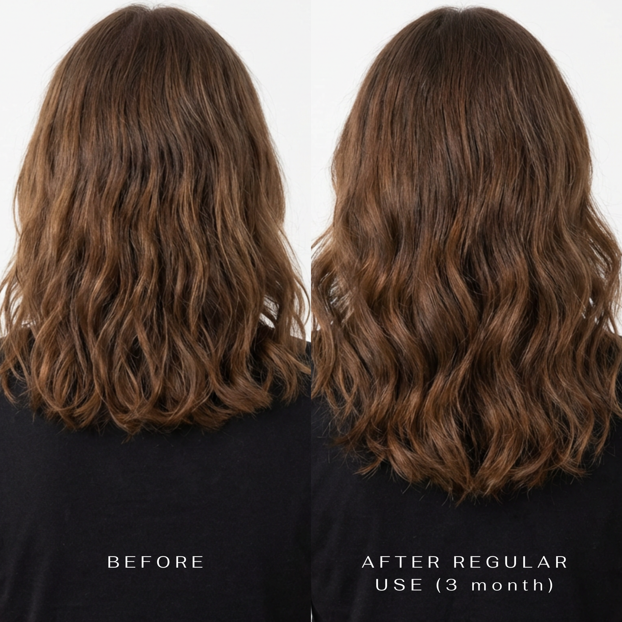 Papildai Grožio kapsulės Revolution in anti-aging solutions