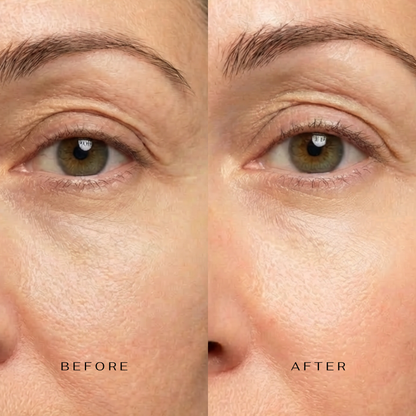 5 Minute Revolution Under-Eye Patches