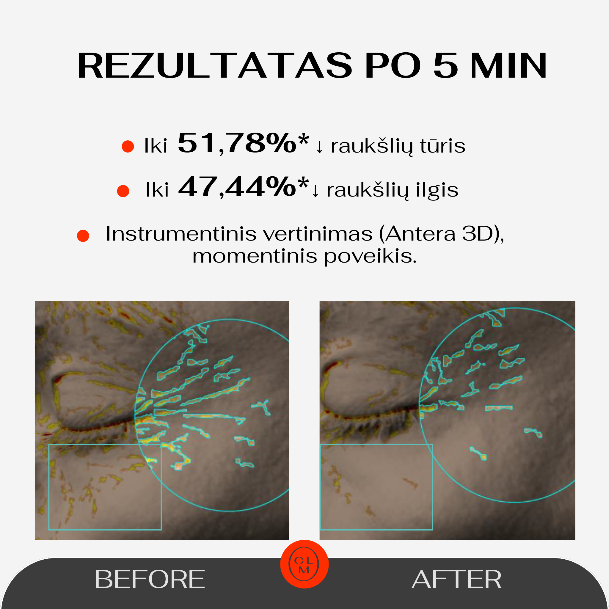 Paakių padeliai 5 Minute Revolution 3ml