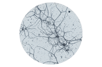 5–20 kDa Hialurono rūgštis